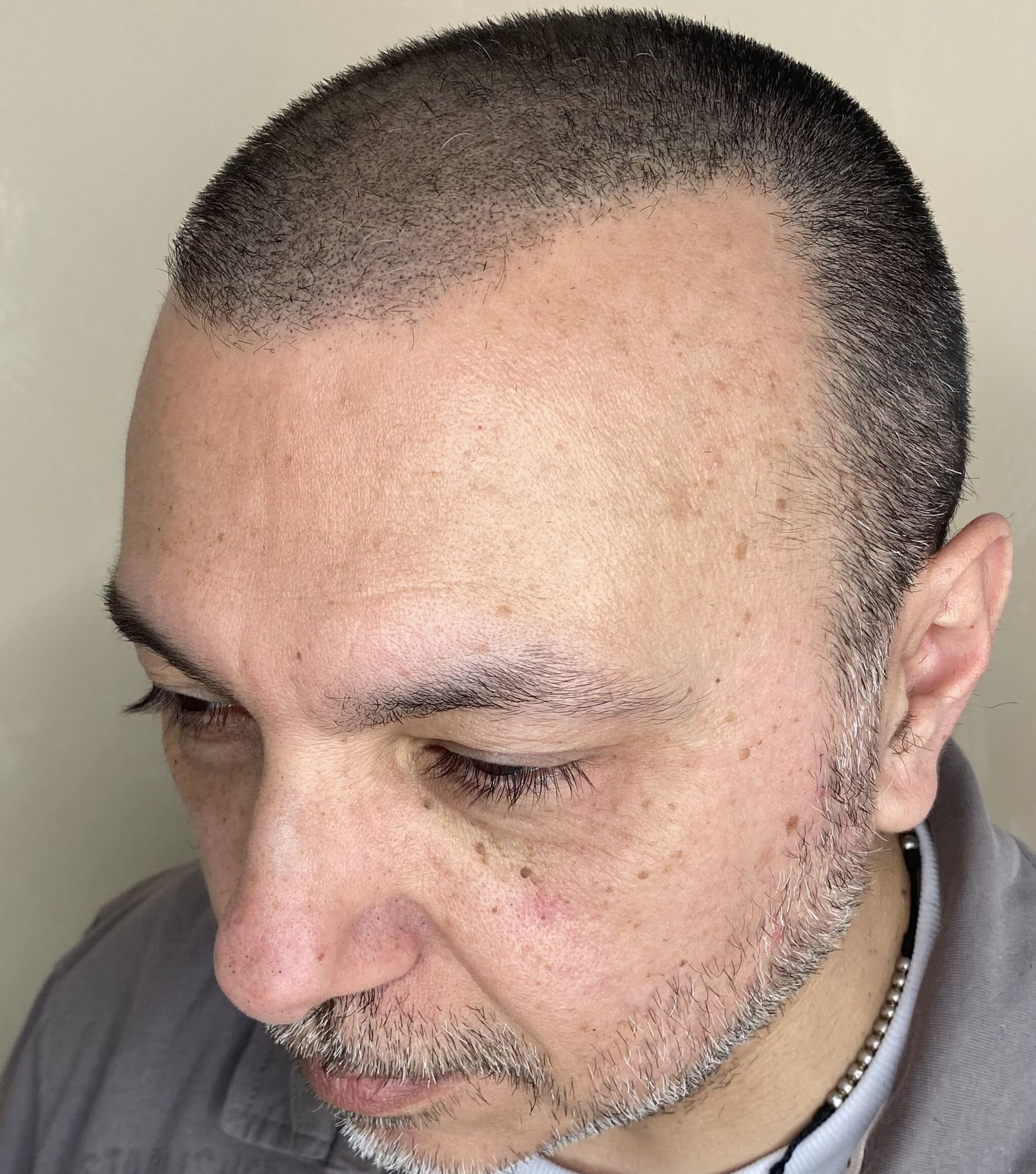 Después Efecto Densidad