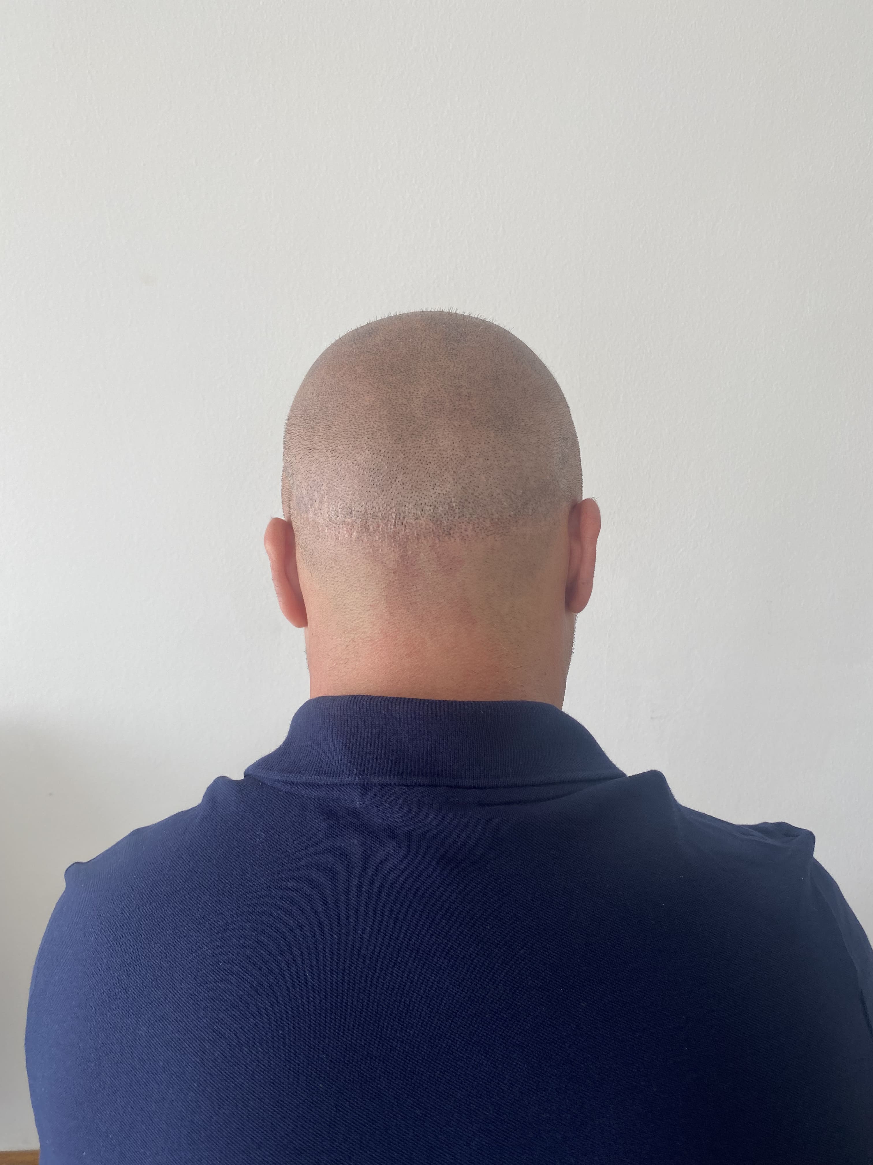 Procedimiento Efecto Rapado