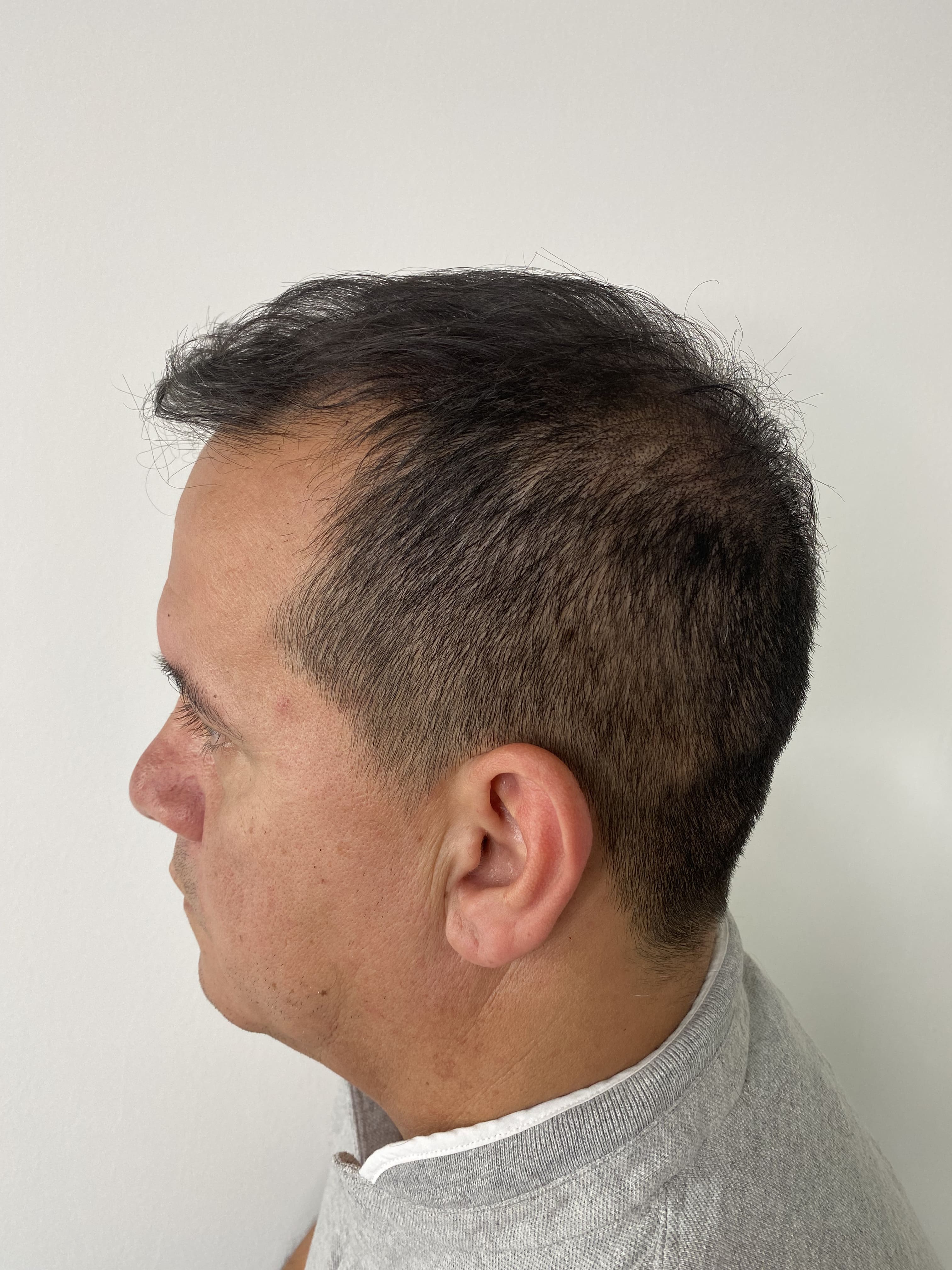 Procedimiento Efecto Rapado